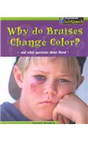 Why Do Bruises Change Color?