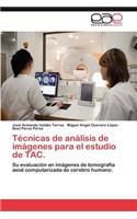 Técnicas de análisis de imágenes para el estudio de TAC.