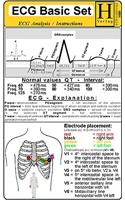 ECG Basic Set: ECG Ruler and Cardiac Arrhythmia and ECG