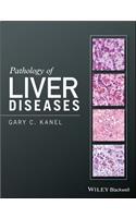 Pathology of Liver Diseases