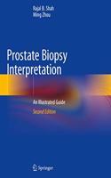 Prostate Biopsy Interpretation