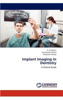 Implant Imaging in Dentistry