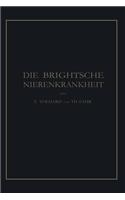 Brightsche Nierenkrankheit