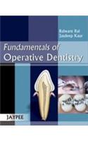Fundamentals of Operative Dentistry