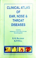 CLINICAL ATLAS OF EAR, NOSE & THROAT DISEASES: INCLUDING ENDOSCOPY OF THE NOSE & SINUSES THYROID & PAROTID
