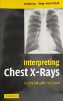 Interpreting Chest X-Rays South Asia Edition: Illustrated with 100 Cases