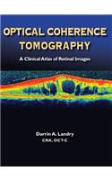 Optical Coherence Tomography