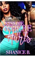 Kiss Me Where It Hurts (Kiss Where It Hurts Book 1)