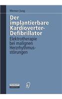 Der Implantierbare Kardioverter-Defibrillator