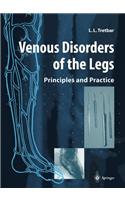 Venous Disorders of the Legs