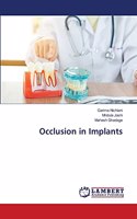 Occlusion in Implants