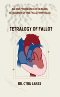 Tetralogy of Fallot