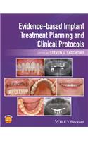 Evidence-Based Implant Treatment Planning and Clinical Protocols