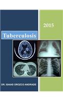 Tuberculosis 2015