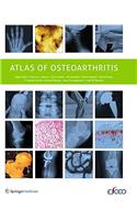 Atlas of Osteoarthritis