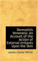 Dermatitis Venenata