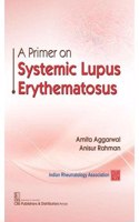 A Primer on Systemic Lupus Erythematosus