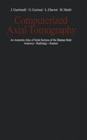 Computerized Axial Tomography