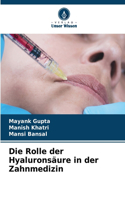 Rolle der Hyaluronsäure in der Zahnmedizin