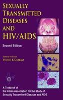 HIV/AIDS