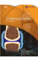 Osteoarthritis