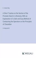 Short Treatise on the Section of the Prostate Gland in Lithotomy; With an Explanation of a Safe and Easy Method of Conducting the Operation on the Principles of Cheselden