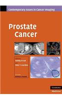 Prostate Cancer