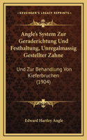 Angle's System Zur Geraderichtung Und Festhaltung, Unregalmassig Gestellter Zahne
