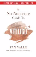A No-Nonsense Guide To Vitiligo