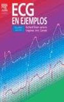 ECG En Ejemplos