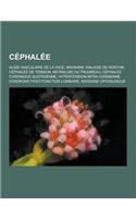 Cephalee: Algie Vasculaire de La Face, Migraine, Maladie de Horton, Cephalee de Tension, Nevralgie Du Trijumeau, Cephalee Chroni