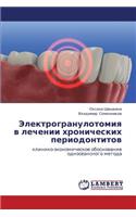 Elektrogranulotomiya V Lechenii Khronicheskikh Periodontitov