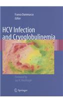 HCV Infection and Cryoglobulinemia