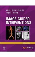 Image-Guided Interventions E-Book: Expert Radiology Series(Expert Radiology)
