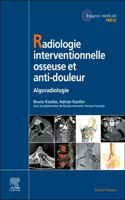 Radiologie Interventionnelle Osseuse Et Anti-Douleur