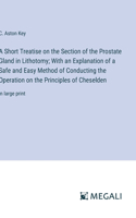 Short Treatise on the Section of the Prostate Gland in Lithotomy; With an Explanation of a Safe and Easy Method of Conducting the Operation on the Principles of Cheselden