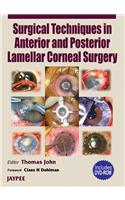 Surgical Techniques in Anterior and Posterior Lamellar Corneal Surgery