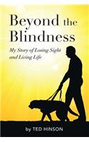 Beyond the Blindness: My Story of Losing Sight and Living Life