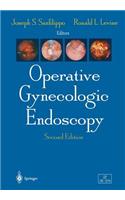Operative Gynecologic Endoscopy