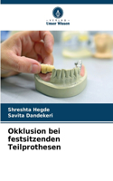 Okklusion bei festsitzenden Teilprothesen