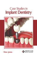 Case Studies in Implant Dentistry