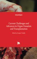 Current Challenges and Advances in Organ Donation and Transplantation