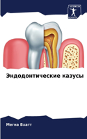 &#1069;&#1085;&#1076;&#1086;&#1076;&#1086;&#1085;&#1090;&#1080;&#1095;&#1077;&#1089;&#1082;&#1080;&#1077; &#1082;&#1072;&#1079;&#1091;&#1089;&#1099;