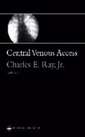 Central Venous Access