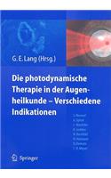 Photodynamische Therapie In der Augenheilkunde-Verschiedene Indikationen