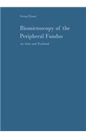 Biomicroscopy of the Peripheral Fundus