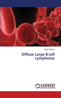 Diffuse Large B-cell Lymphoma