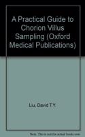 Practical Guide to Chorion Villus Sampling