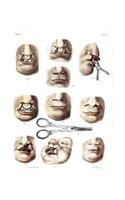 Surgery to Repair Cleft Lip Composition Notebook