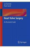 Heart Valve Surgery